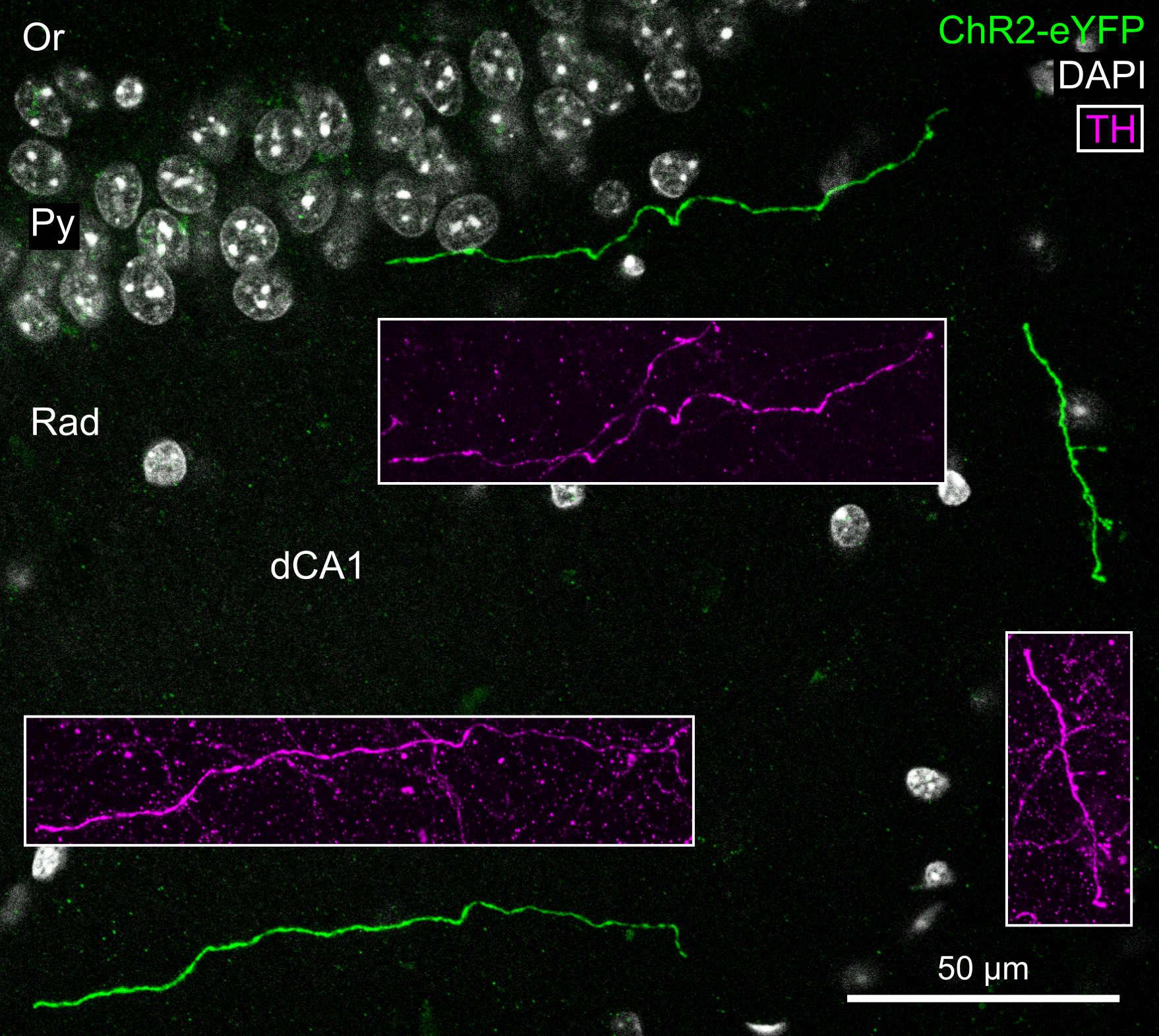 Dopaminergic axons in the hippocampus