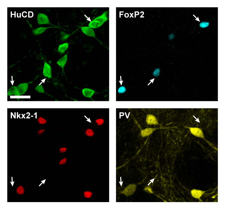 The molecular building blocks of cellular diversity in the external globus pallidus: All types of GPe neuron are revealed with immunoreactivity for HuCD (green). Arkypallidal neurons are revealed with FoxP2 (light blue), whereas prototypic GPe neurons express Nkx2-1 (red) and often PV (yellow).