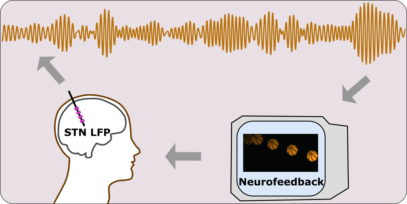 A cartoon of a human brain, some nerve cell activity and a computer monitor, together illustrating three important components in the experiments published by He and colleagues.