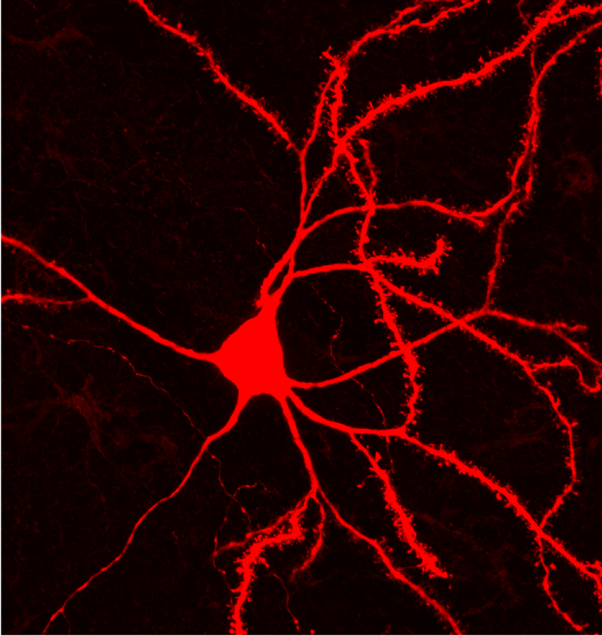 A foundation for striatal function: a spiny projection neuron.