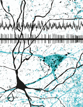 GABAergic medial septal neuron