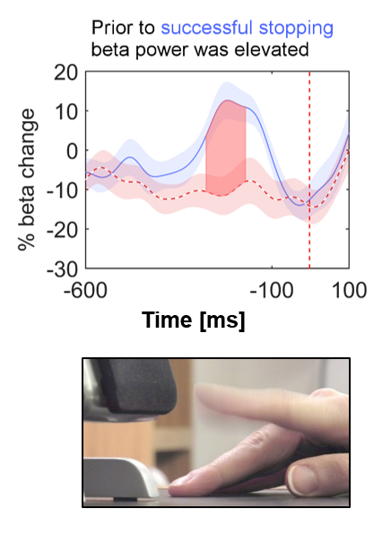 The stop signal (red vertical line) instructed the participant to interrupt the upcoming finger tap. When beta activity in the brain was relatively high, stopping was more successful.