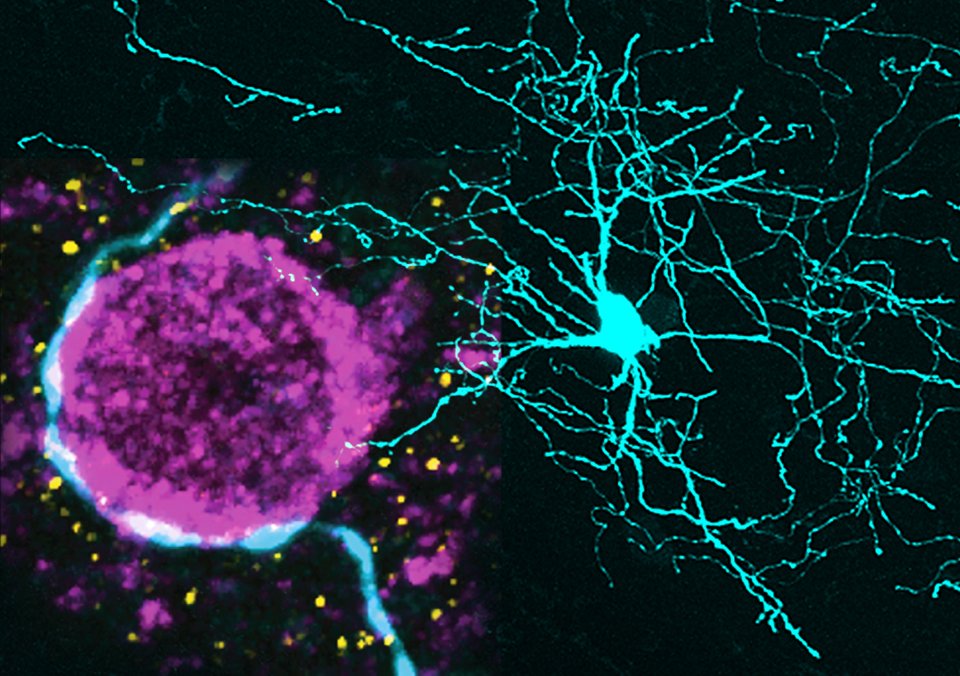 Left side: High-magnification image of the axon of a single striatal interneuron (light blue) that is making presumed synaptic connections with the cell body of a projection neuron (purple). Right side: Lower-magnification image of a striatal interneuron that was recorded and labelled in vivo.