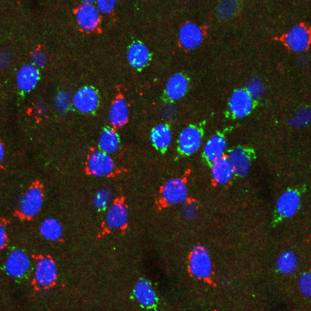 Two different types of spiny projection neuron (labelled with blue and green markers or with blue and red markers) in the dorsal striatum.