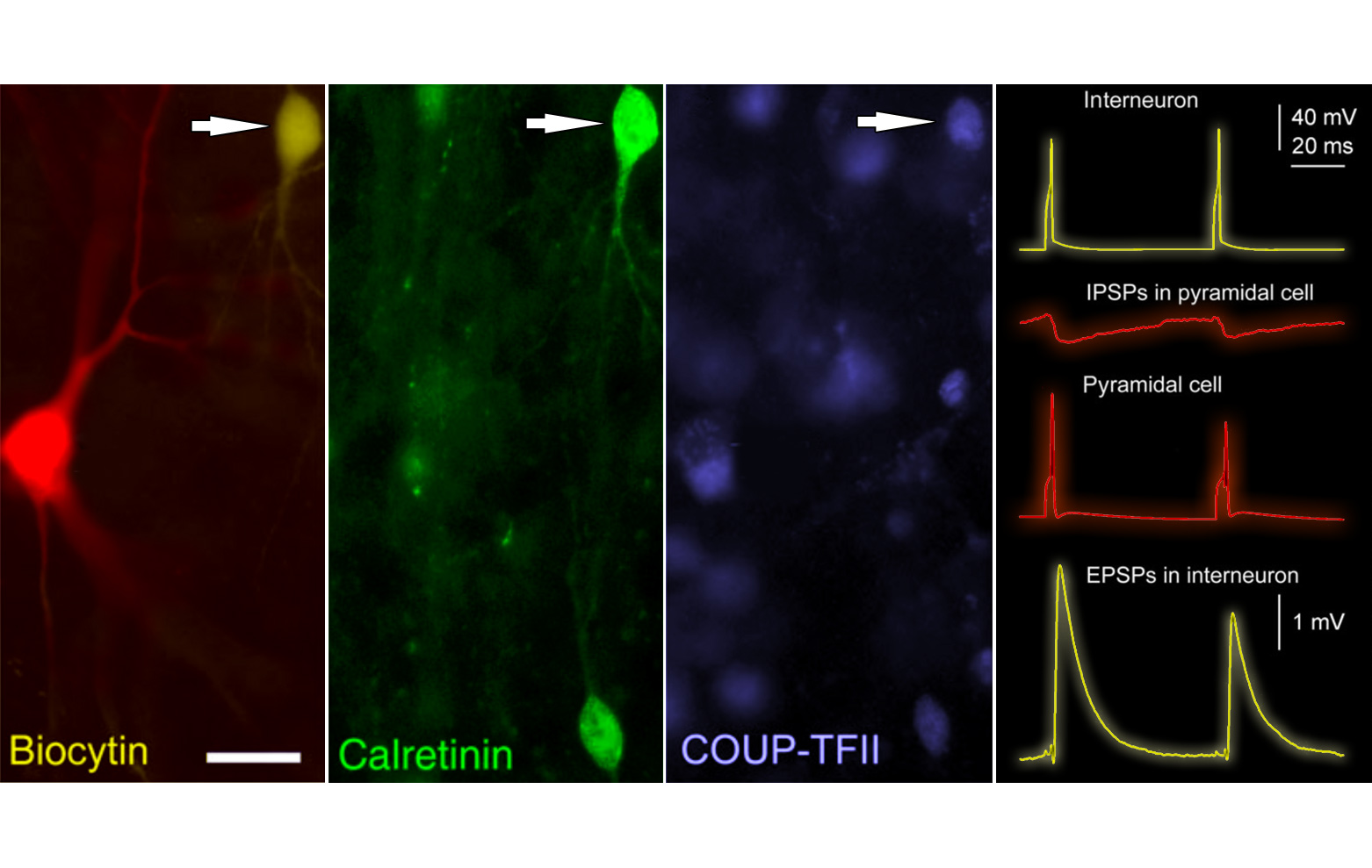in vitro recorded and labeled human cortical neurons