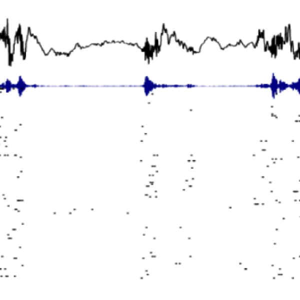 A picture of electrophysiological data recorded from mouse hippocampus.