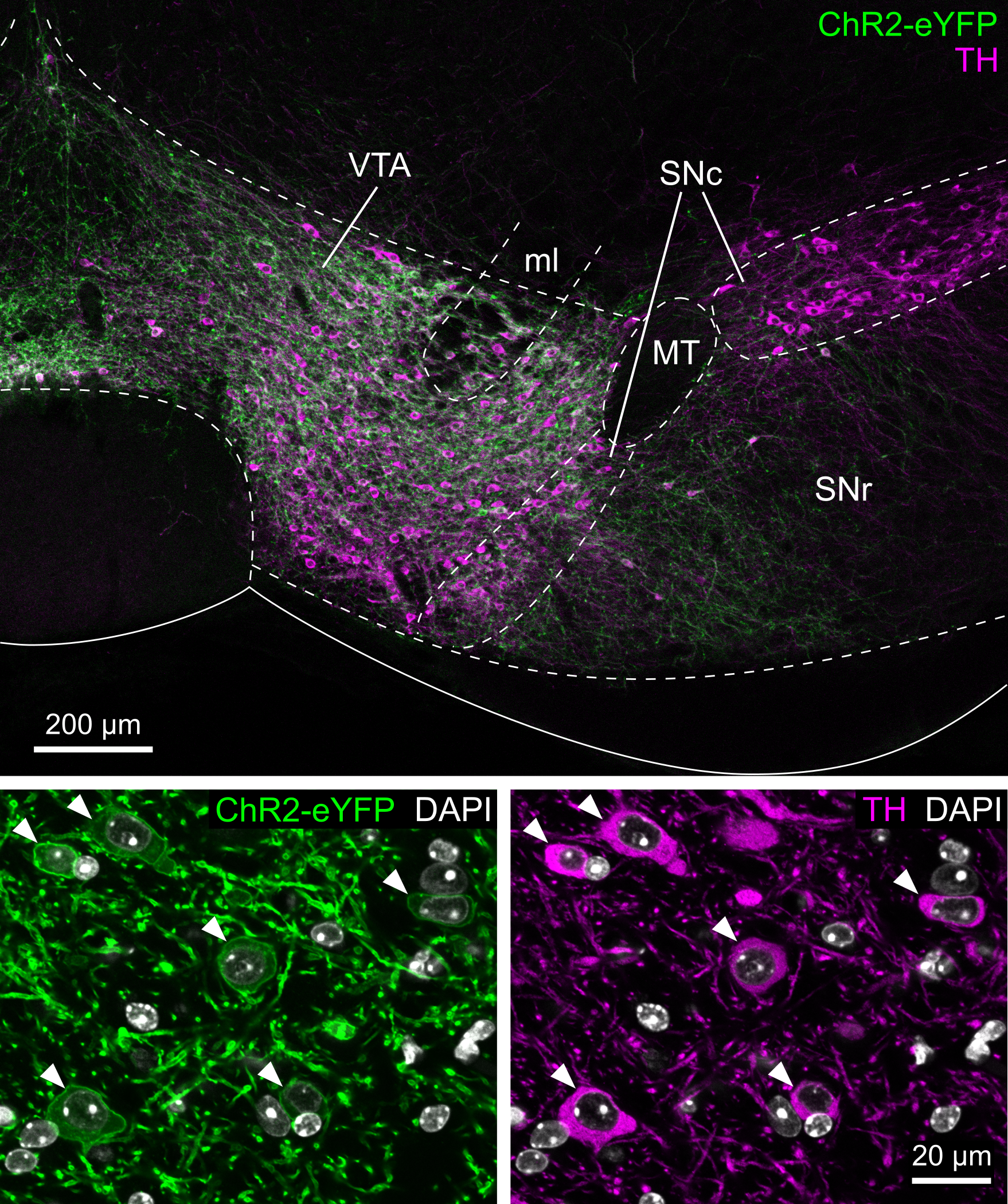 Dopaminergic cells in the Ventral Tegmental Area (VTA)